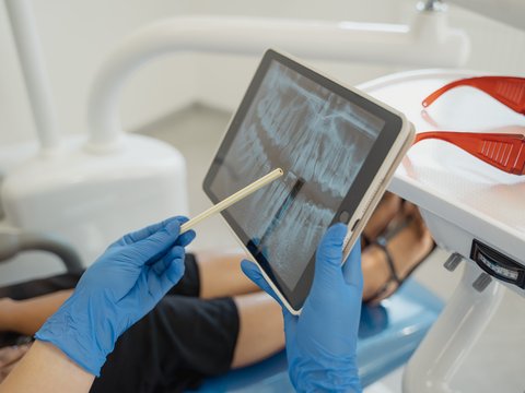 Consulta de un dentista donde enseña una radiografía a la paciente. 