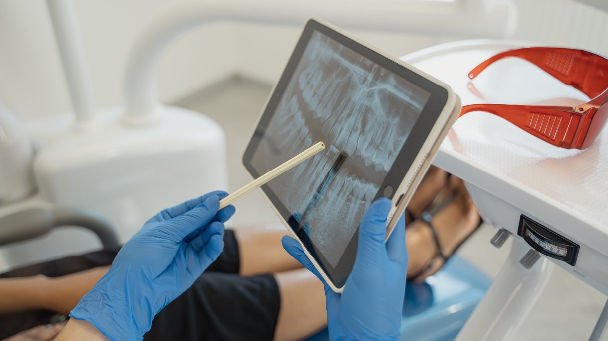 Consulta de un dentista donde enseña una radiografía a la paciente. 