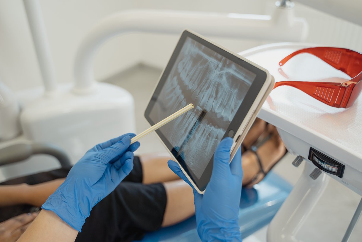 Consulta de un dentista donde enseña una radiografía a la paciente. 